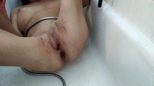 Lizzy Yum - Lizzy Yum Post Op love juice-hole And Verification